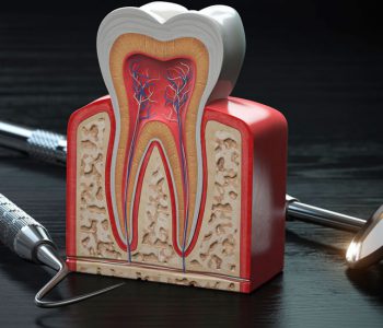 Endodontia | Sayd Odontologia