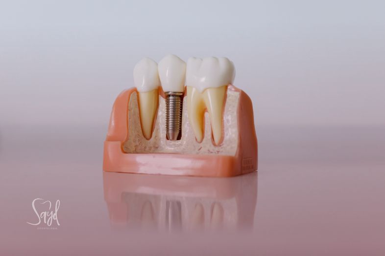 Implante dentário dói?