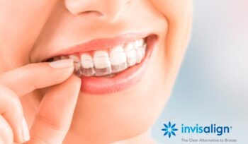 vantagens do invisalign