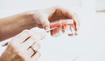 O Que São Implantes Dentários?