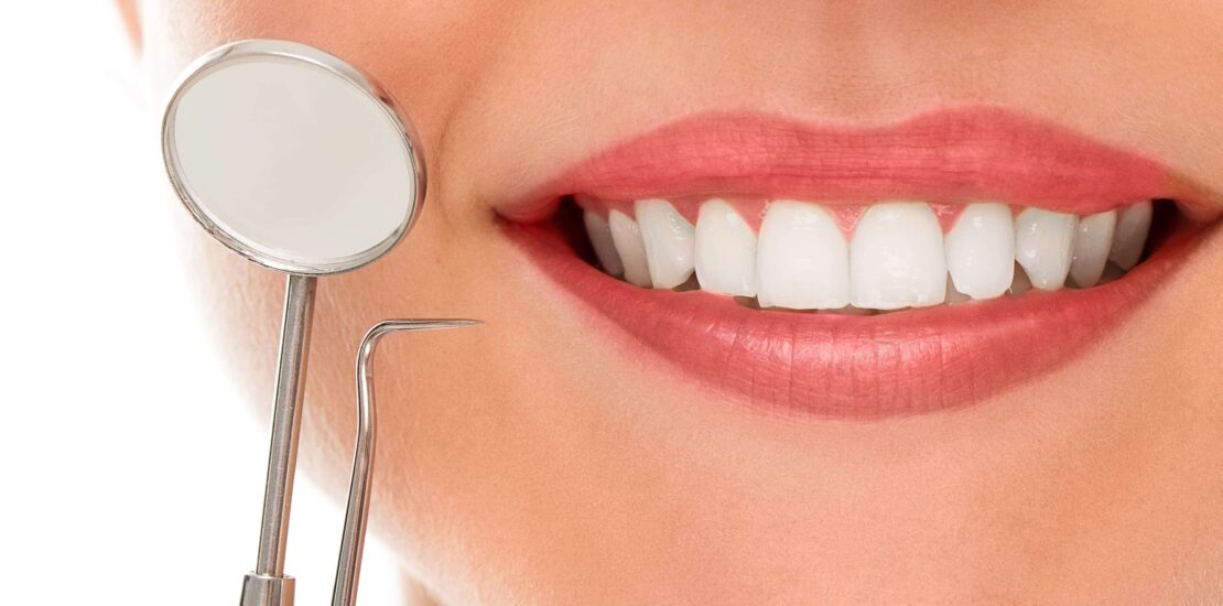 Clareamento dental: como funciona | Sayd Odontologia