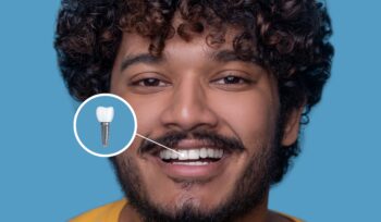 Questões frequentes sobre implantes dentários e Invisalign | Sayd Odontologia