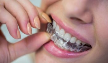 Diferentes tipos de tratamentos ortodônticos | Sayd Odontologia