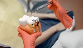 Cáries dentárias: como prevenir e tratar para um sorriso saudável | Sayd Odontologia