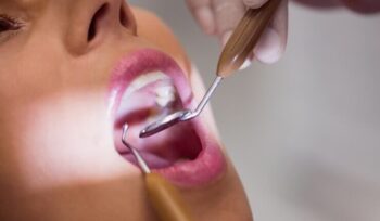 Como o tratamento de canal pode influenciar na aparência do sorriso | Sayd Odontologia