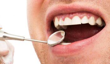 Gengivectomia: o que é e quando é necessária para sua saúde bucal | Sayd Odontologia