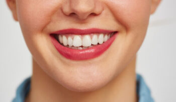 procedimento-estético-clareamento-dental