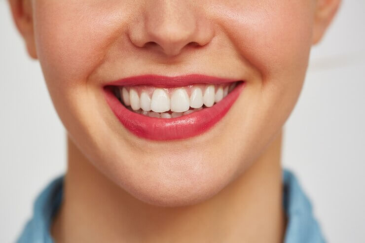 procedimento-estético-clareamento-dental